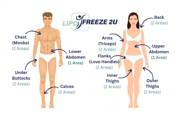 Areas you can have fat freezing treatment Warwick