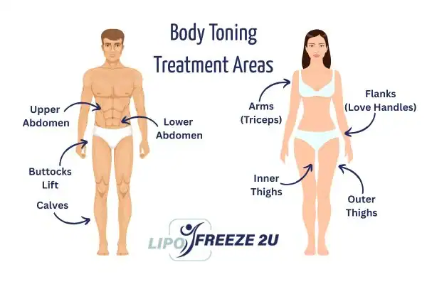 Graphic showing where you can have Body toning Treatment Warwick on your body