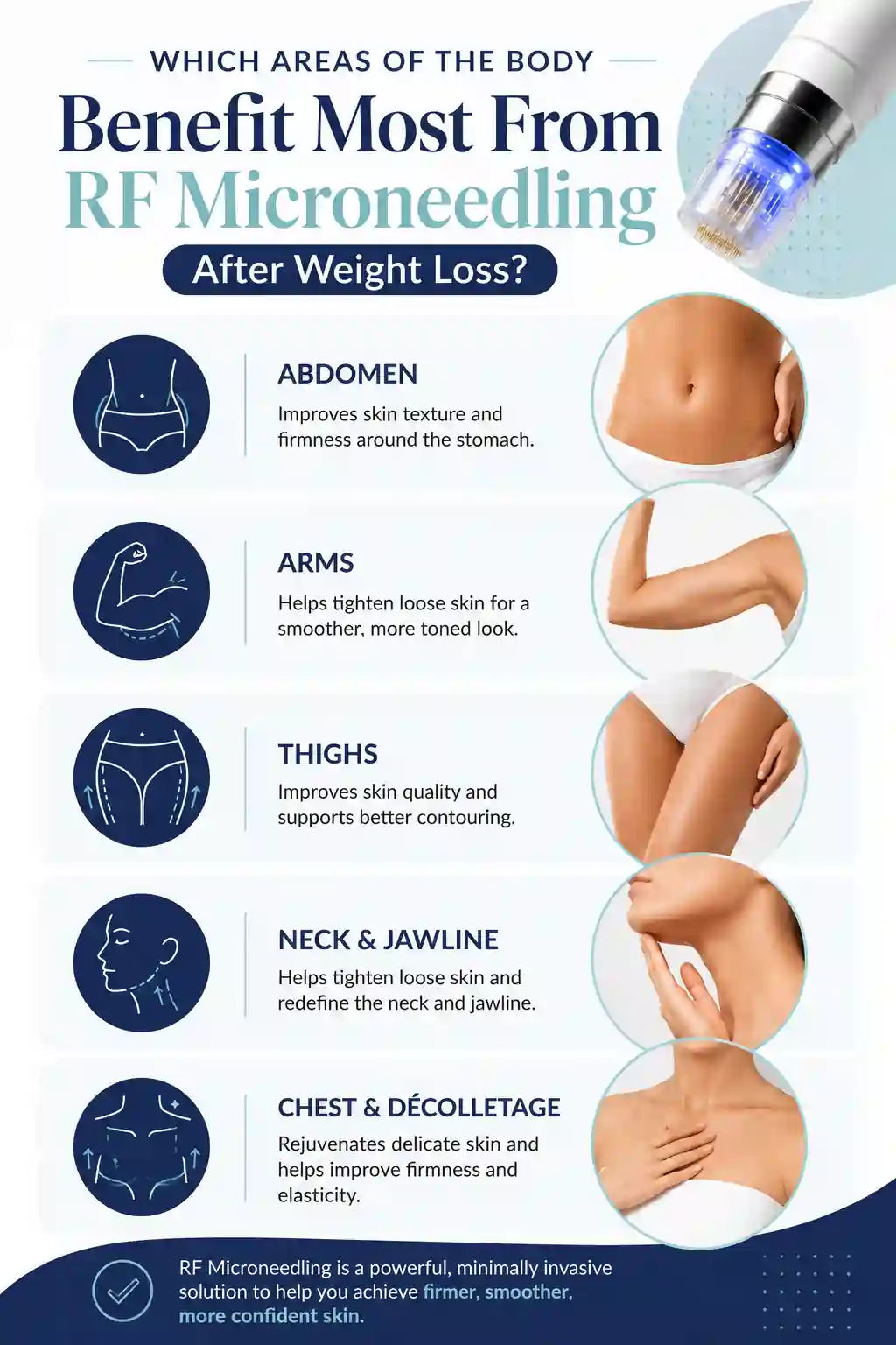 Which Areas of the Body Benefit Most From RF Microneedling After Weight Loss Warwick